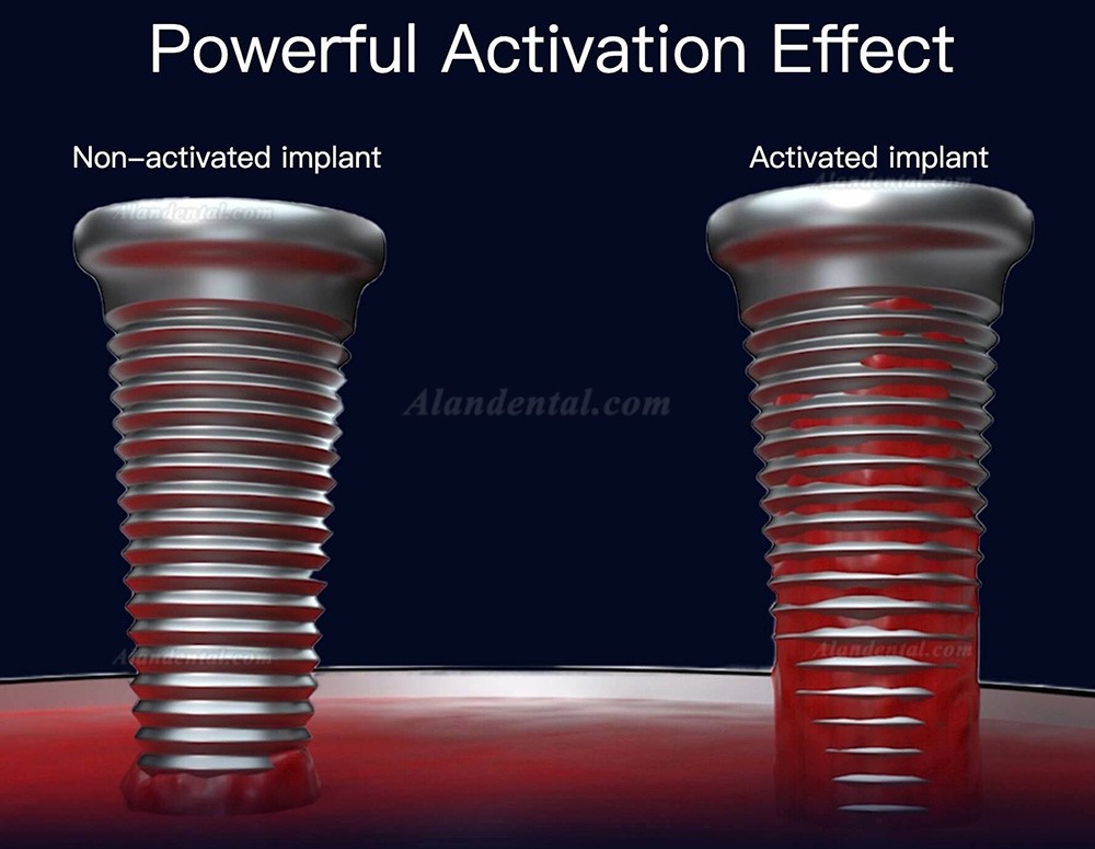COXO UA-1 Dental Implant UV Activator Hydrophilic Apparatus